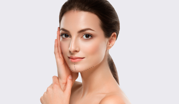 Cirugía de Mentón (Mentoplastia)