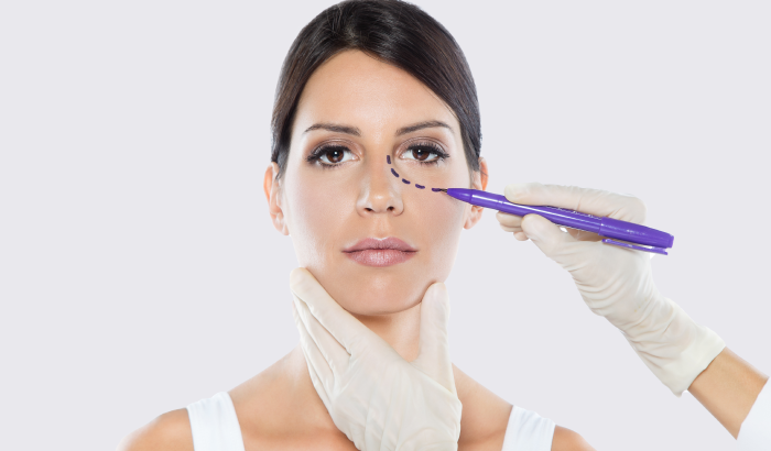 Cirugía de Párpados (Blefaroplastia)